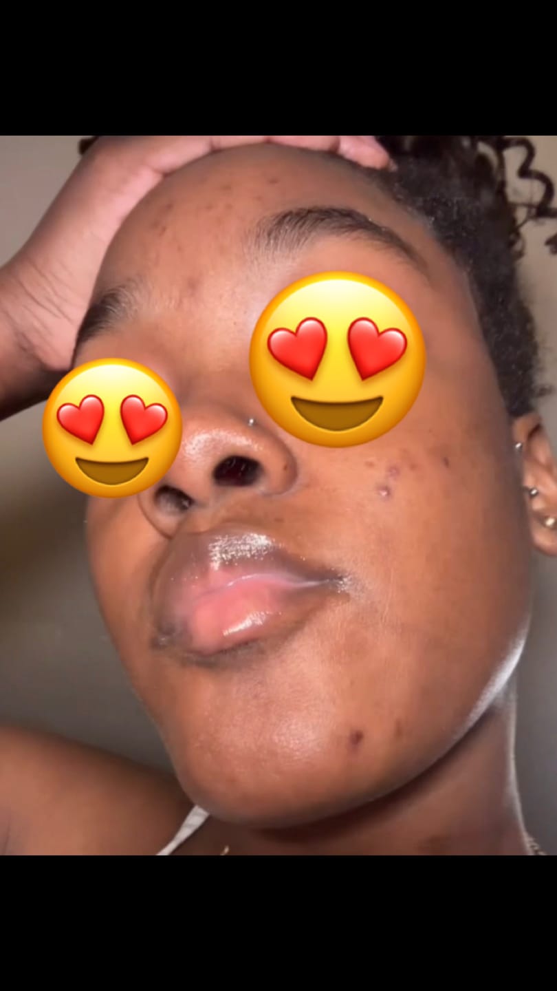 Customer photo review of Duo Skincare Bundle