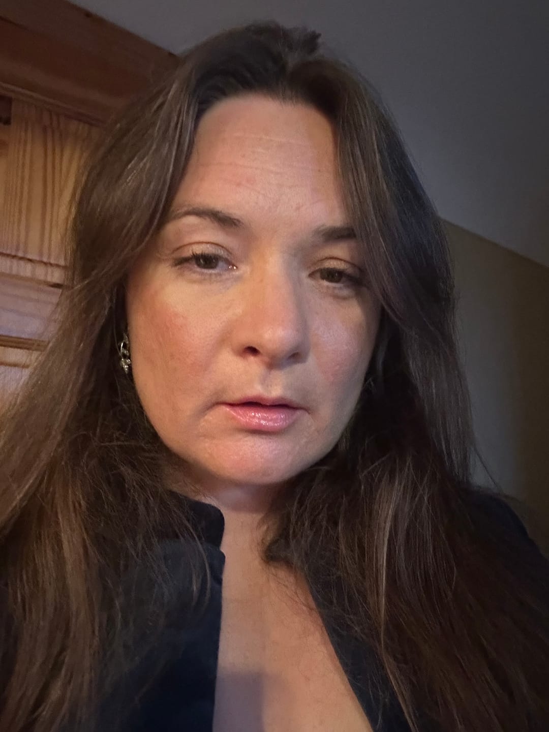 Customer photo review of Rosalique 3 in 1 Anti-Redness Miracle Formula SPF50