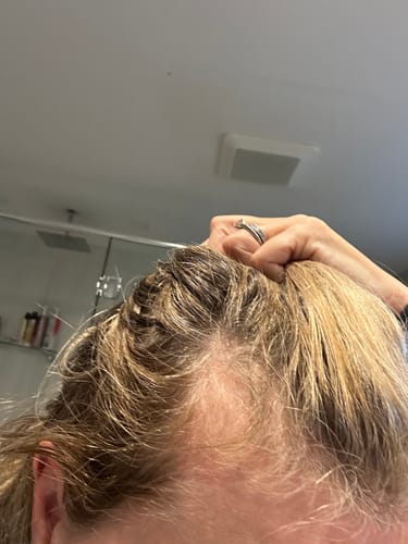 Customer photo review of TR Hair Oil Essentials Bundle ($66 value)