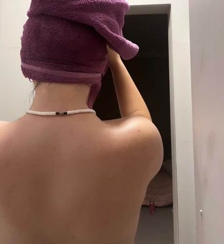 Customer photo review of Bumps Be Gone