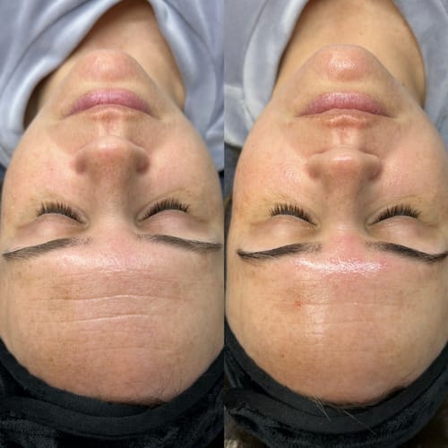 Reviewer's before-and-after image showing smoother, hydrated skin after using the Elite Essence Soothing Elixir.