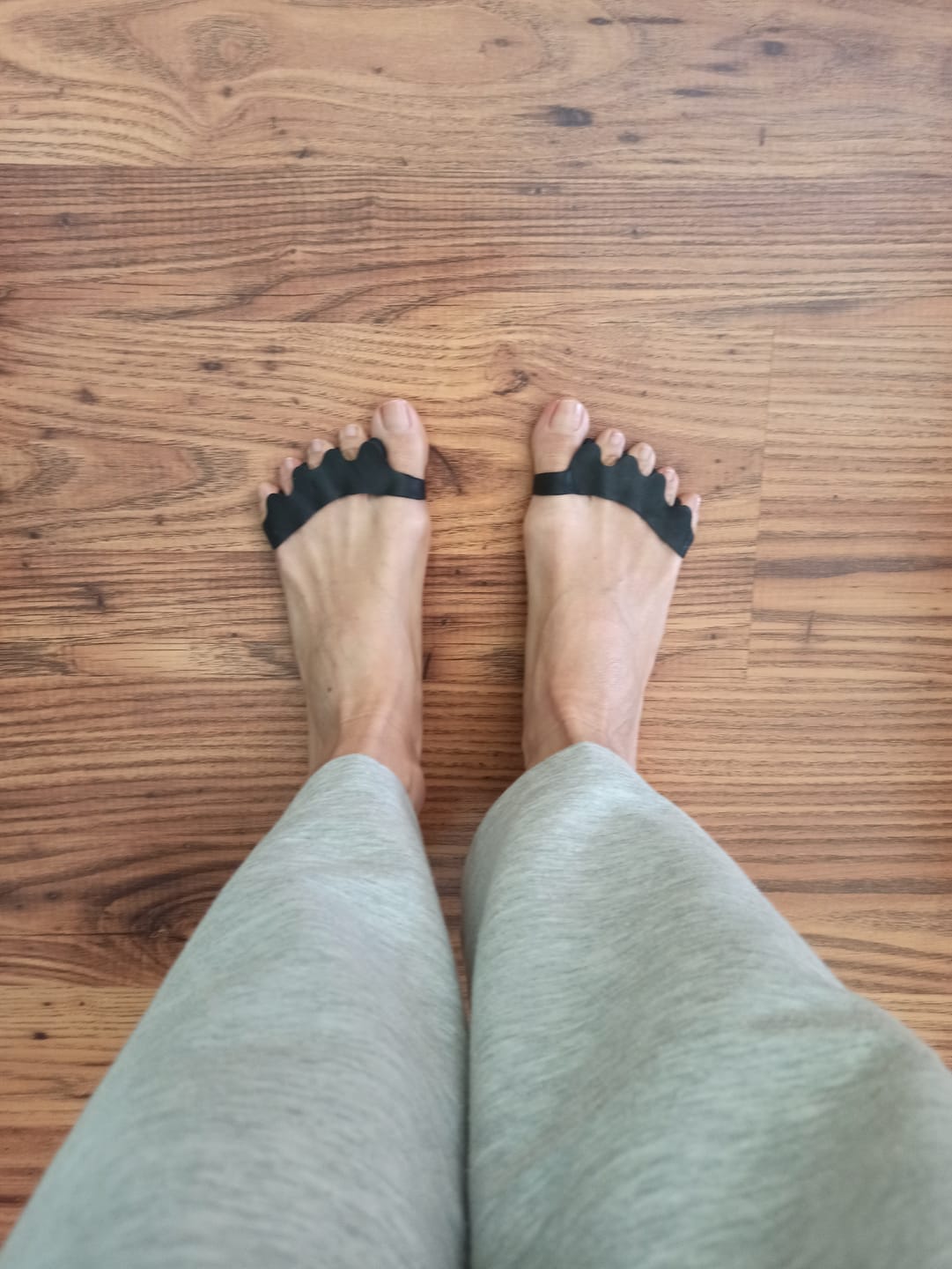 Customer photo review of Separadores de dedos