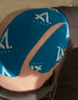 Customer photo review of A.LEAF MK-Tape, Stick It To Your Pain