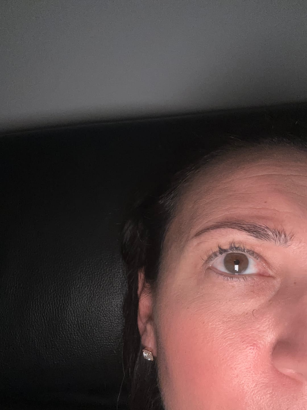 Customer photo review of EYEBAGHACK -  Express Eyelift Effect
