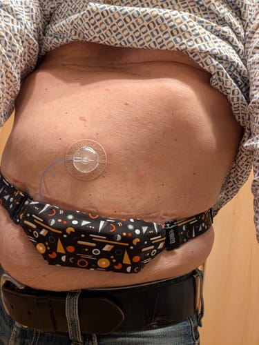 Customer photo review of Versatile Insulin Pump Pouch - Dia-Body Pouch Basic