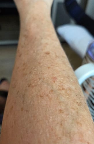 Customer photo review of TryTallow™ Grass-Fed Tallow Balm (4oz)