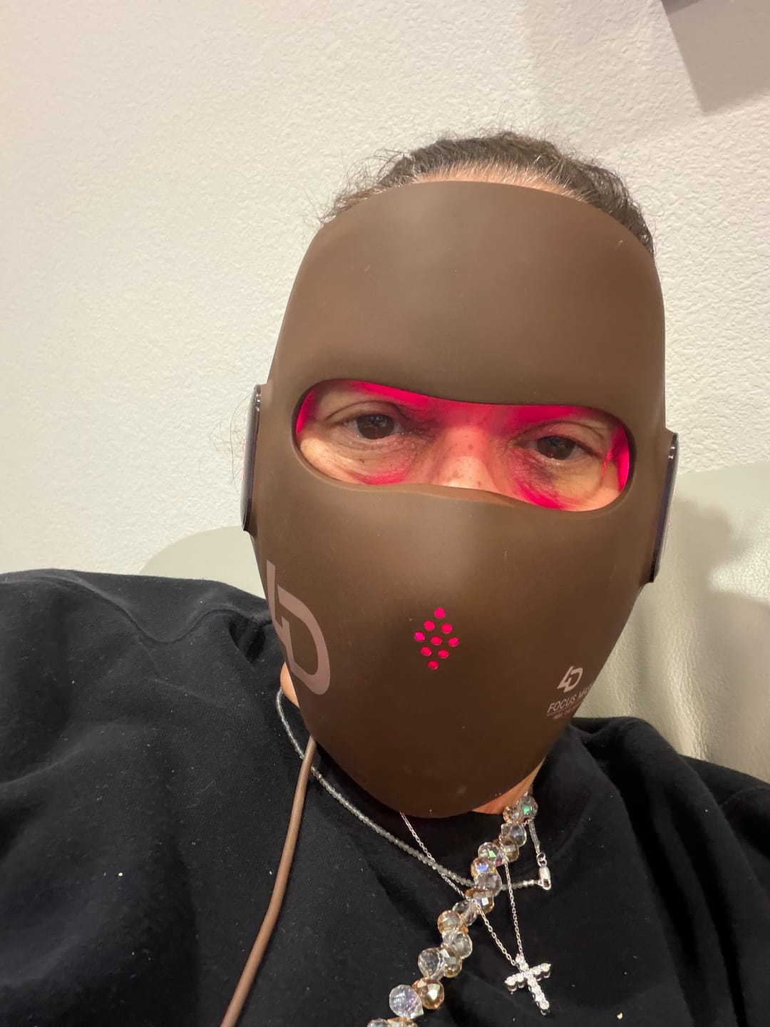 Customer photo review of JOVS 4D Laser Light Therapy Mask