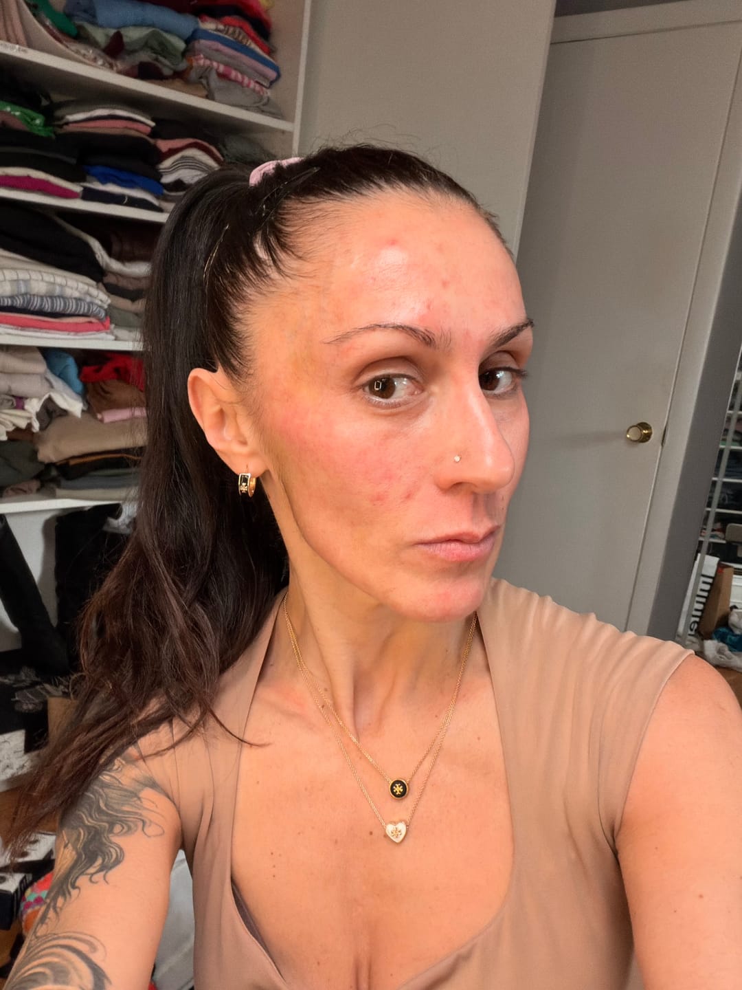 Customer photo review of Glov Micro Infusion System