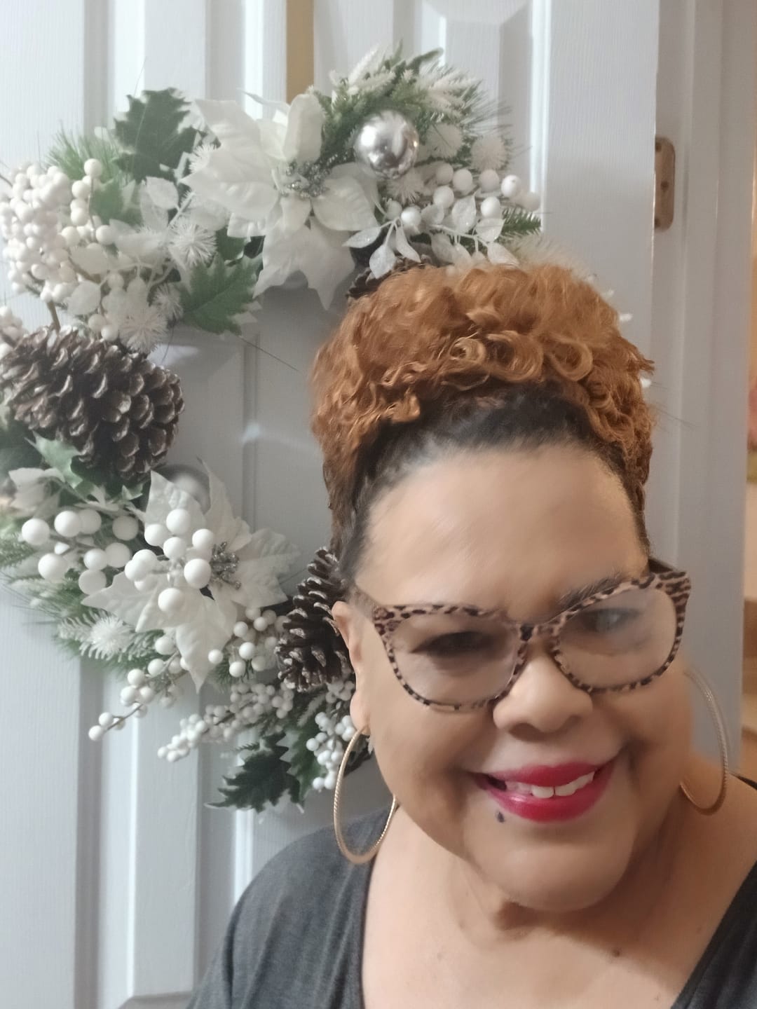 Customer photo review of Magic Eraser Dark Spot Cream