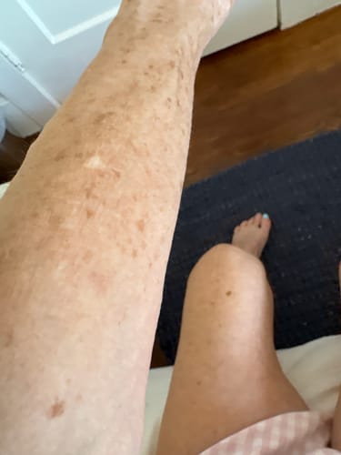 Customer photo review of Besque® Magic Body Oil XL - 200ml