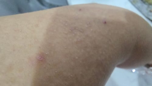 Customer photo review of Jolicare Cream
