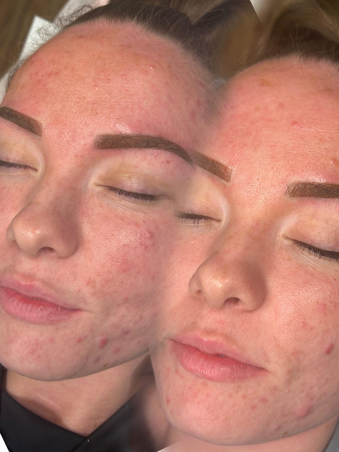 Customer photo review of LED Face Mask