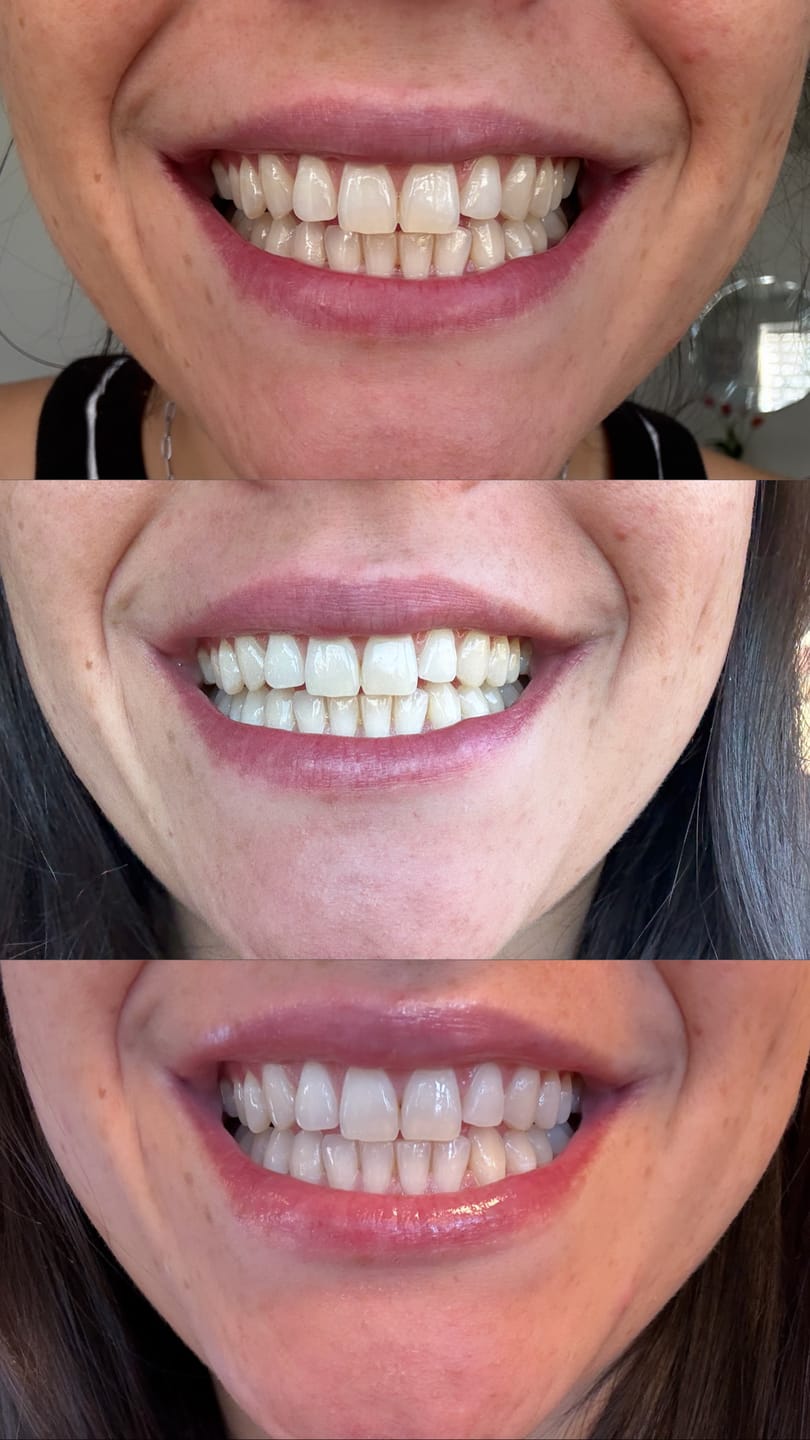 Customer photo review of Kit Smile+