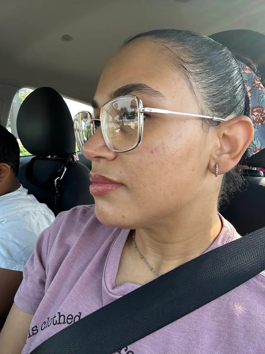 Customer photo review of CLEAR Mindbodyskin® Equilibrio hormonal interno elimina el acne de raiz