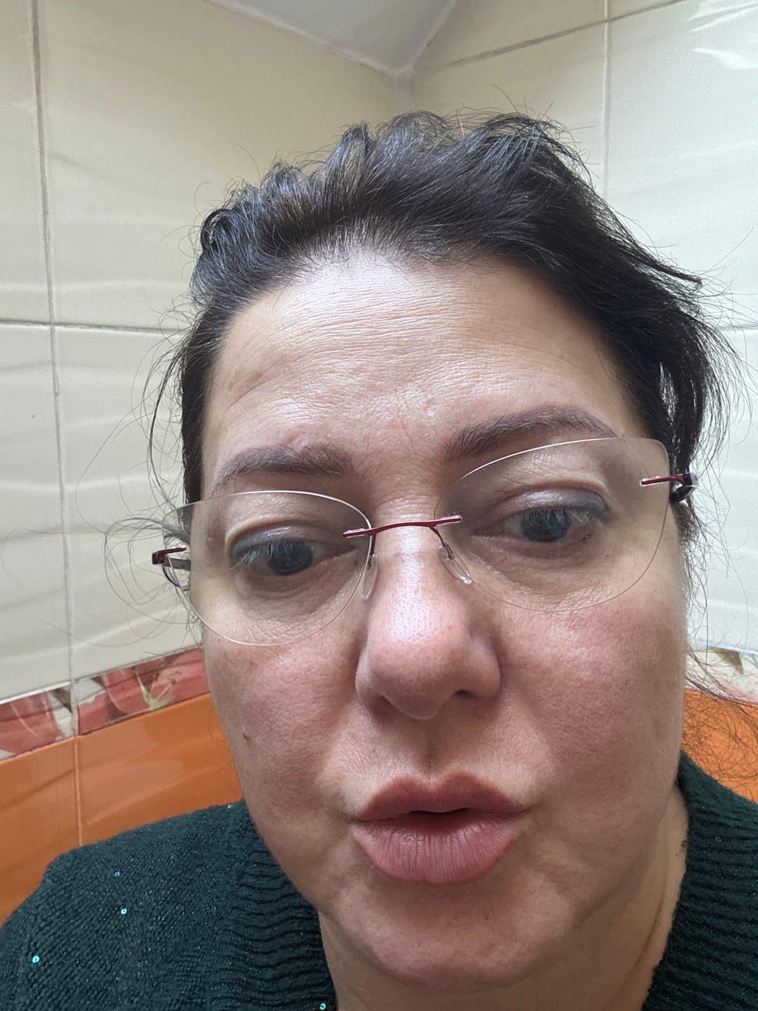 Customer photo review of BIOBALANCE СУПЕР СЕРУМ 24K ЗЛАТО И ПЕПТИДИ, ПРИ “ПАЧИ КРАК” И МИМИЧЕСКИ БРЪЧКИ