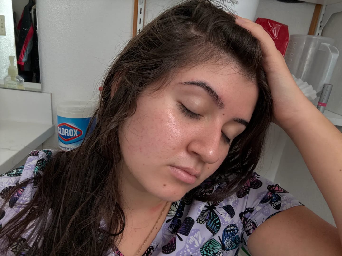 Customer photo review of CLEAR Mindbodyskin® Equilibrio hormonal interno elimina el acne de raiz