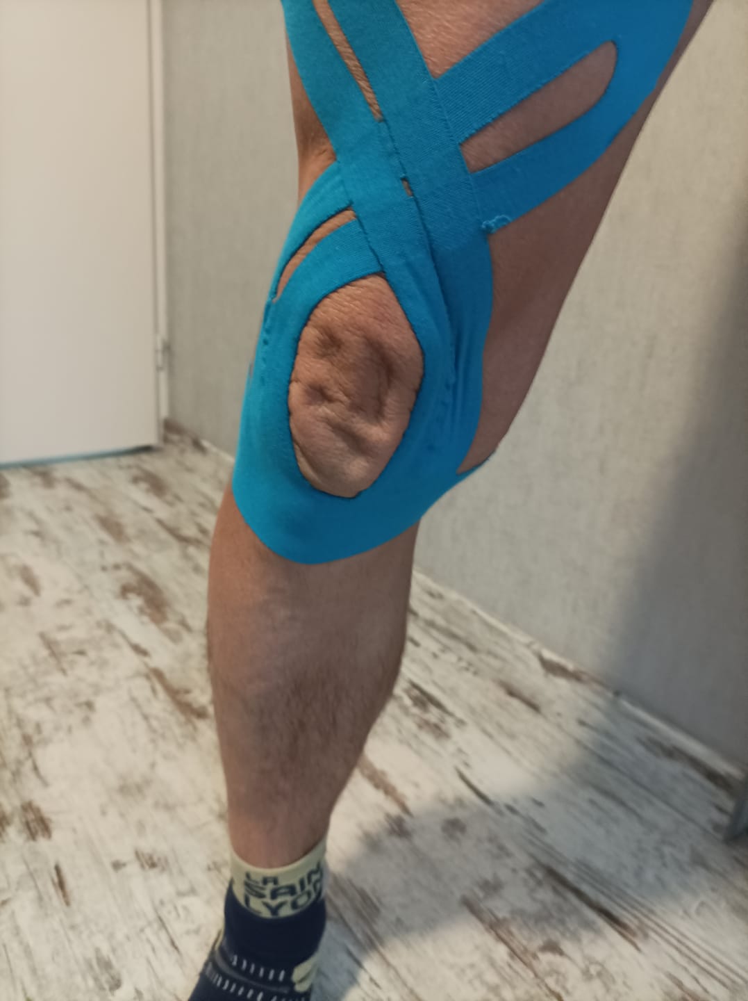 Customer photo review of Flex Pro - Bandes pour genoux