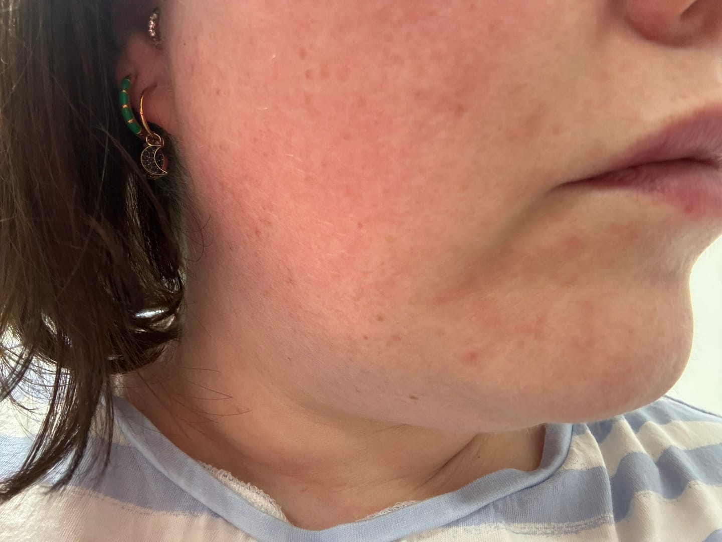 Customer photo review of Grass-Fed Tallow Soap | Moisturising Cleansing Bar