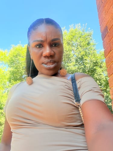 Customer photo review of Minoxidil 5% SOLUTION, 3x60ml pack