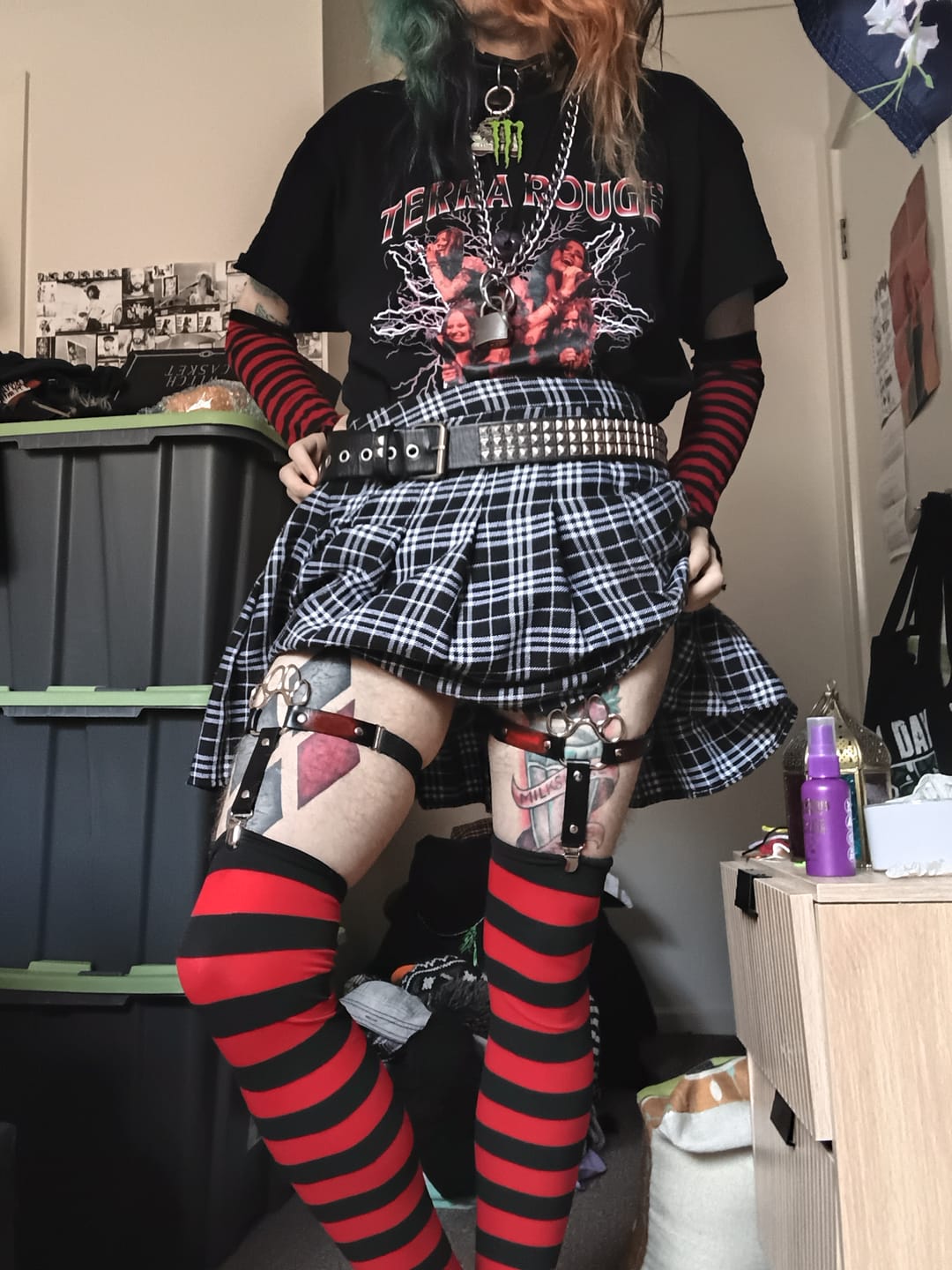 Customer photo review of ToeBeanies Black Sock Garters