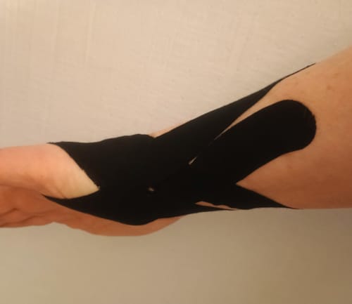 Kundenbewertung mit Foto zu TAPEX™ - Handgelenk