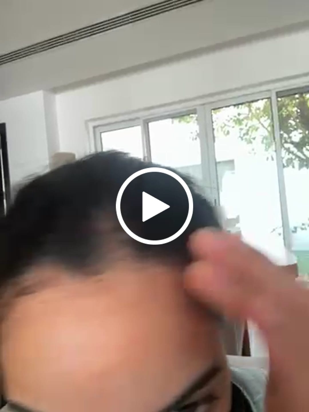 Customer video review of لوشن إي سي إم نوفوفان رياكشنال لعلاج تساقط الشعر – 100مل