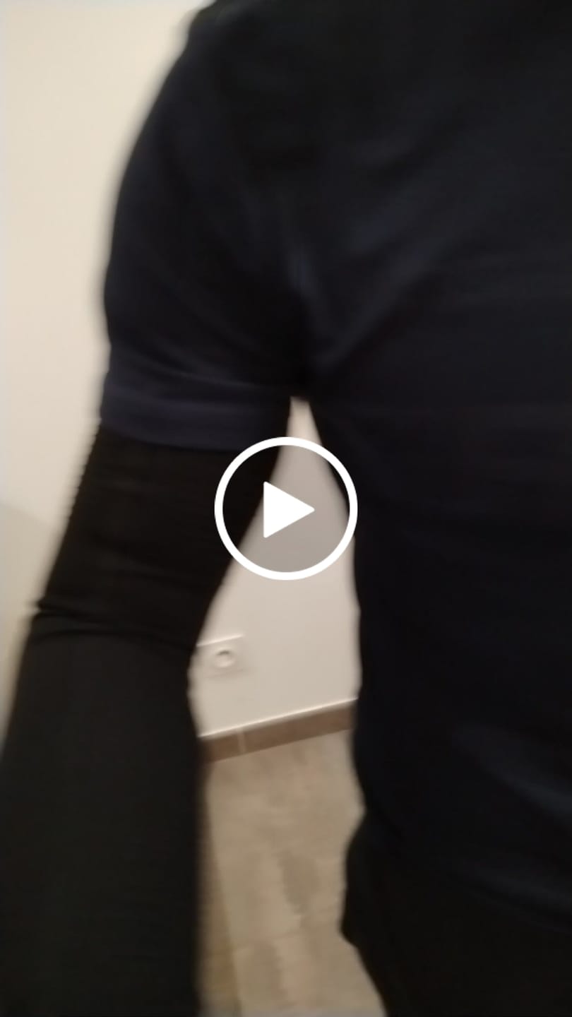 Customer video review of Manchon de compression pour bras