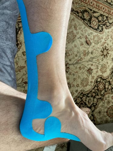 Kundenbewertung mit Foto zu TAPEX™ - Achillessehne