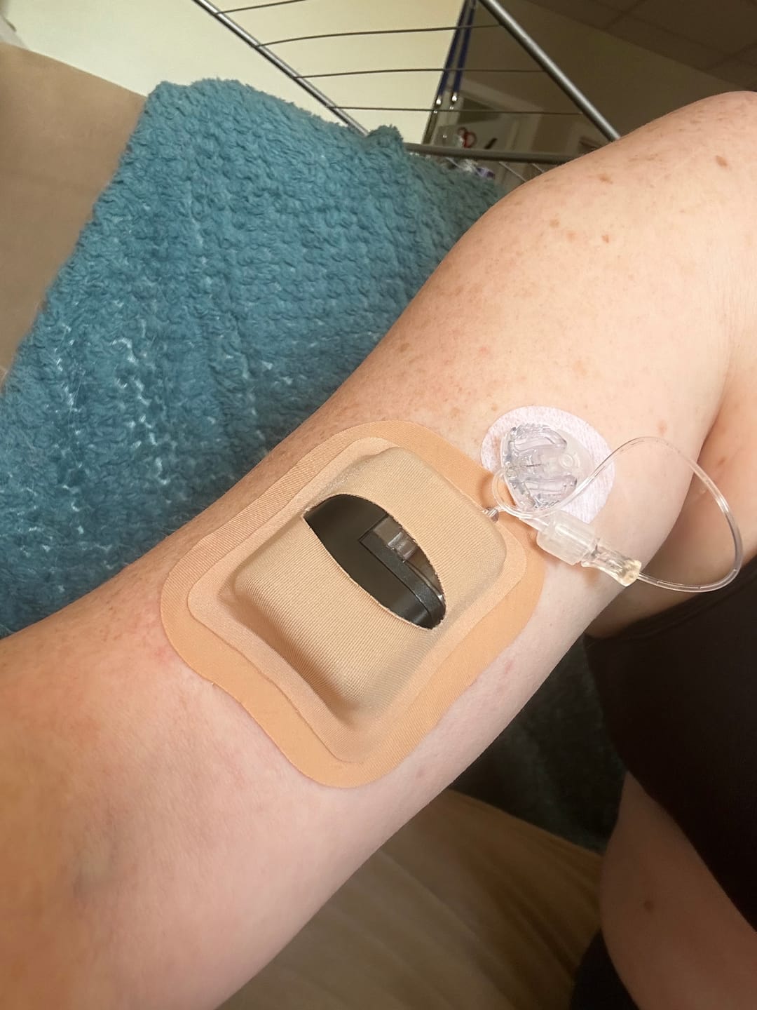 Customer photo review of Skin Grip - Tandem Mobi Pocket Patch
