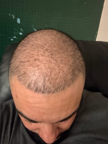 Customer photo review of Miracle Hair Growth Oil