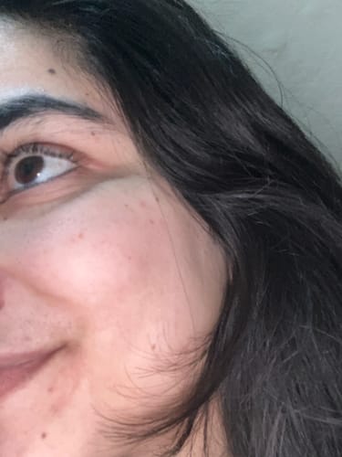Close-up of a reviewer's face showing their skin after using the Essense Deep Cleansing Facewash.