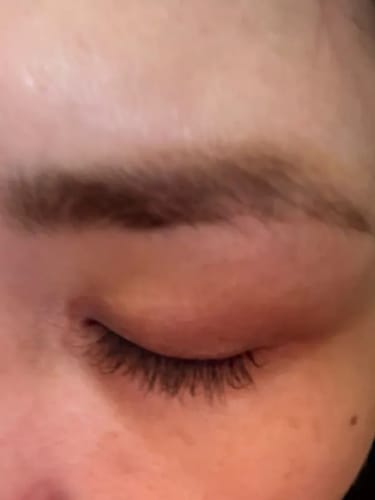Customer photo review of Toplash eyelash and eyebrow growth serum — 3ml