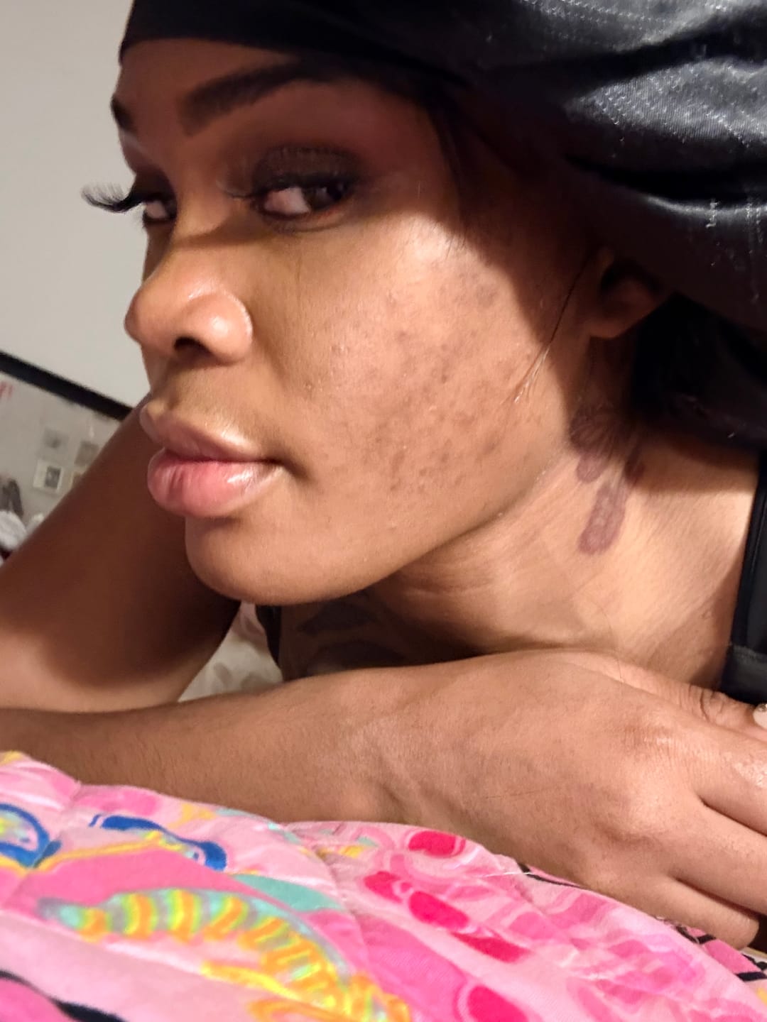 Customer photo review of Melanin Skin Bundle