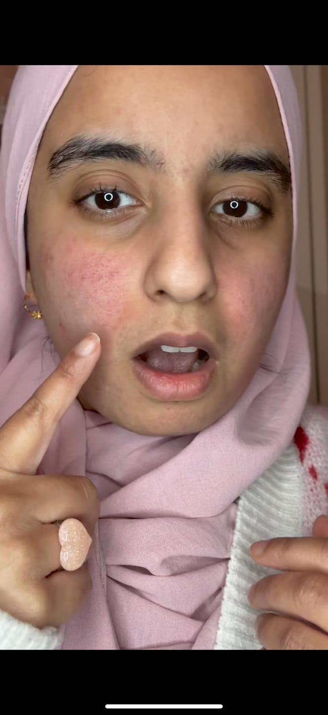 Customer photo review of PDRN glow serum 4.0 pump