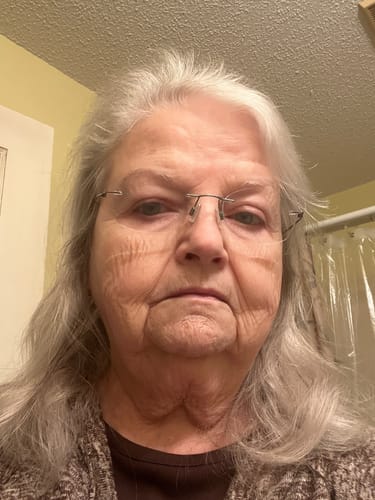 Customer photo review of Weightless Oil for Fine & Medium Hair