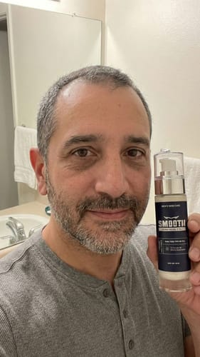 Customer photo review of Crema Facial 5 en 1