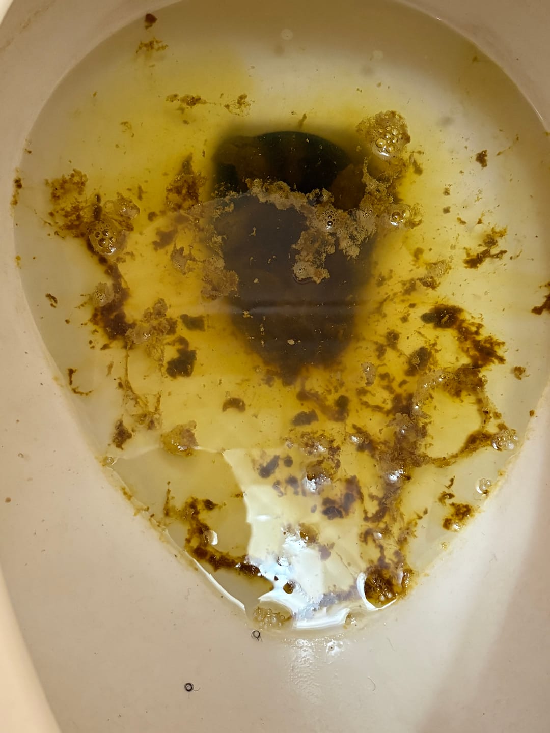 Customer photo review of 7 PARASITE CLEANSE