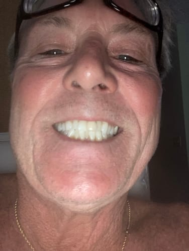 Customer smiling in a close-up to show whitened teeth from using Chilled Mint Nicotine Pouches.