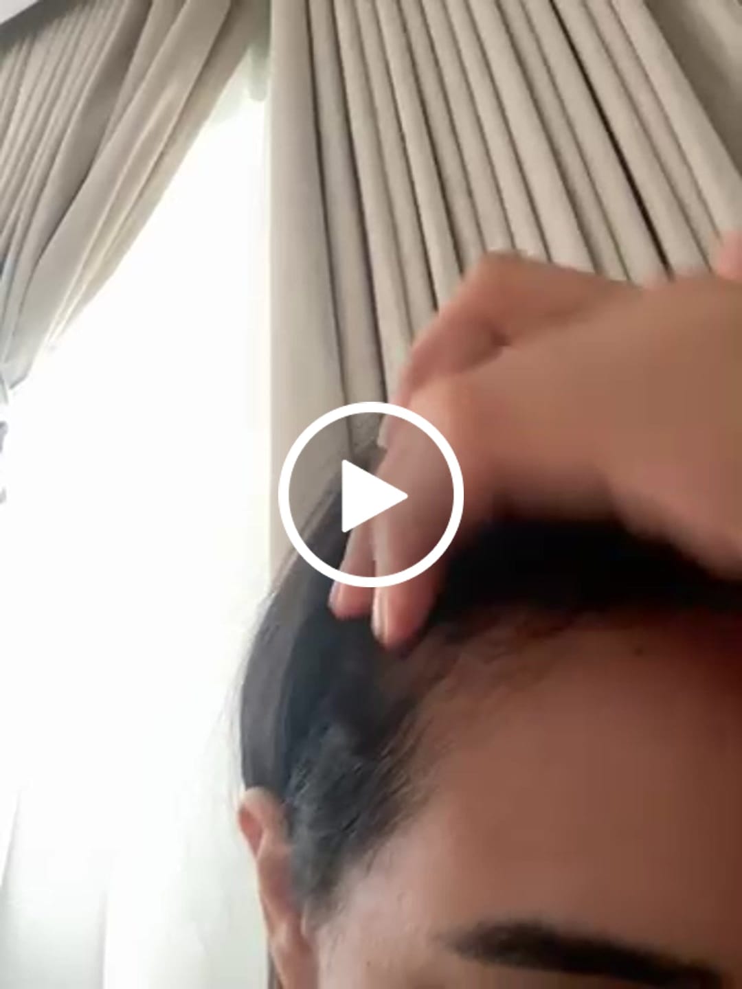 Customer video review of لوشن إي سي إم نوفوفان رياكشنال لعلاج تساقط الشعر – 100مل