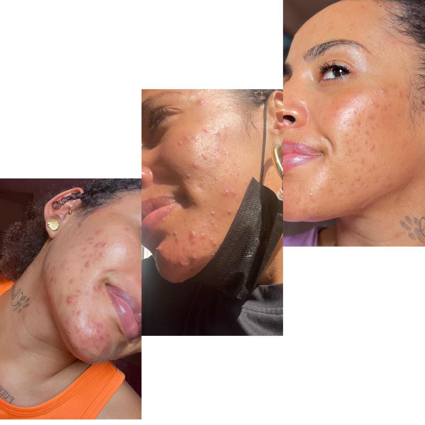 Customer photo review of A CONTROL + CORTIZEN - Equilibrio hormonal desde el cerebro, los ovarios, la piel y el metabolismo.