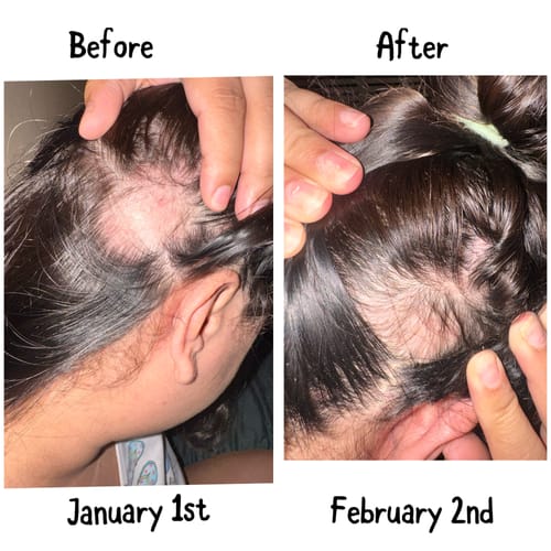 Customer photo review of Hair ReGrowth Serum