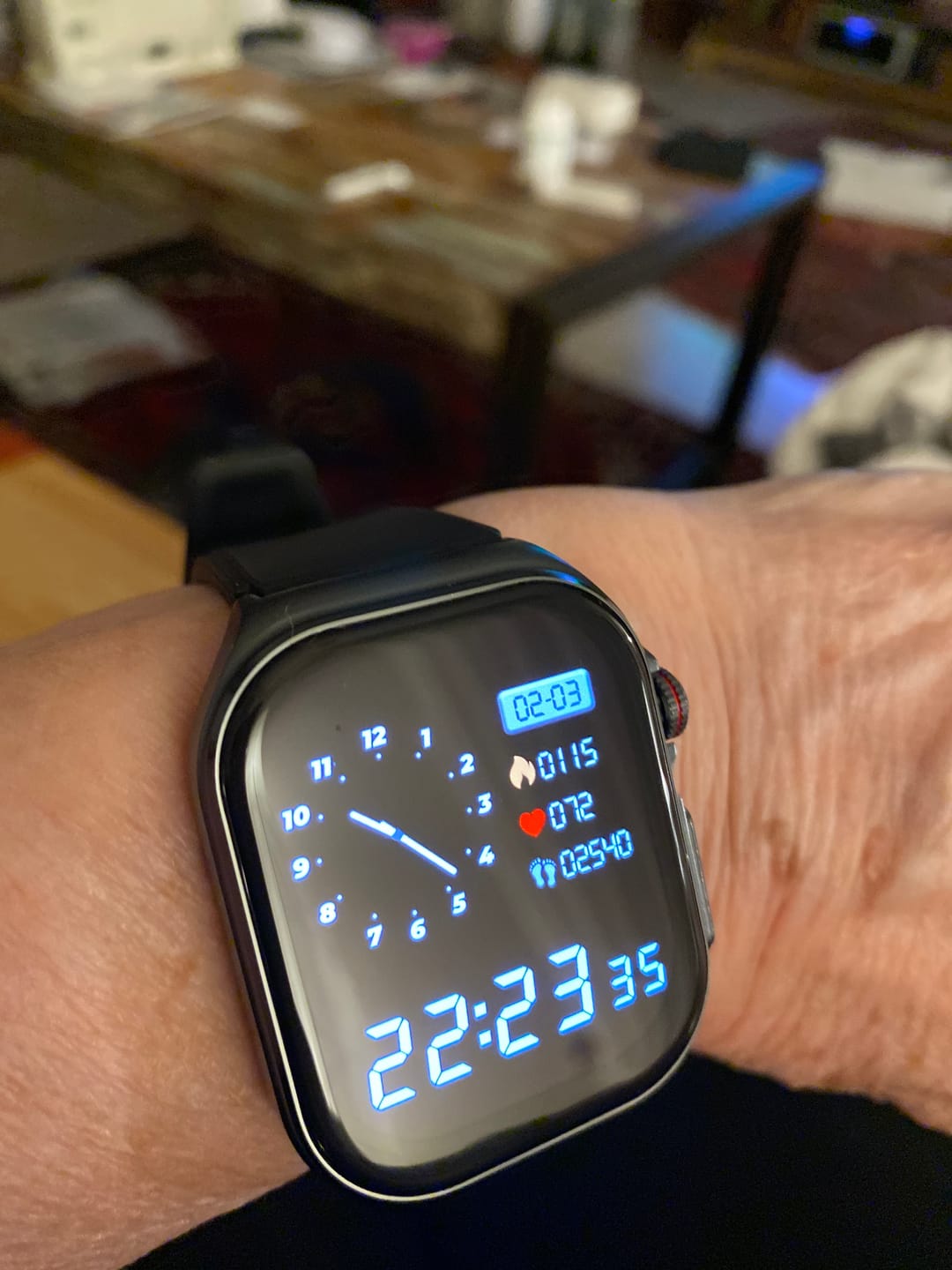Customer photo review of Orthowatch Arca