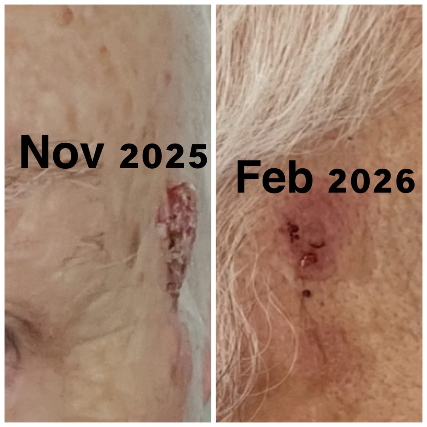 Customer photo review of MAGNESIUM SUPER STICK