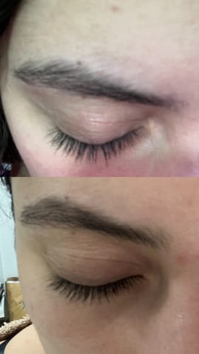 Customer photo review of KosmaLash® | Sérum Crecimiento & Anticaída