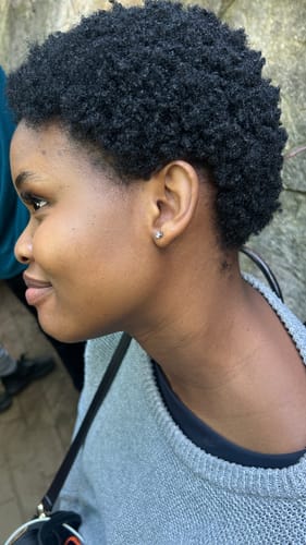 Customer photo review of Derma Roller 0.75MM