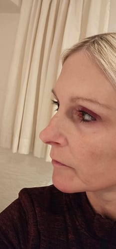 Customer photo review of LASHCOCA!NE - Wimpernserum