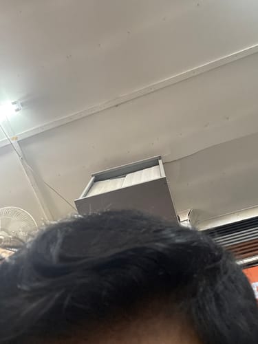 Customer photo review of Minoxidil High Strength (5%) SOLUTION, 3x60ml pack