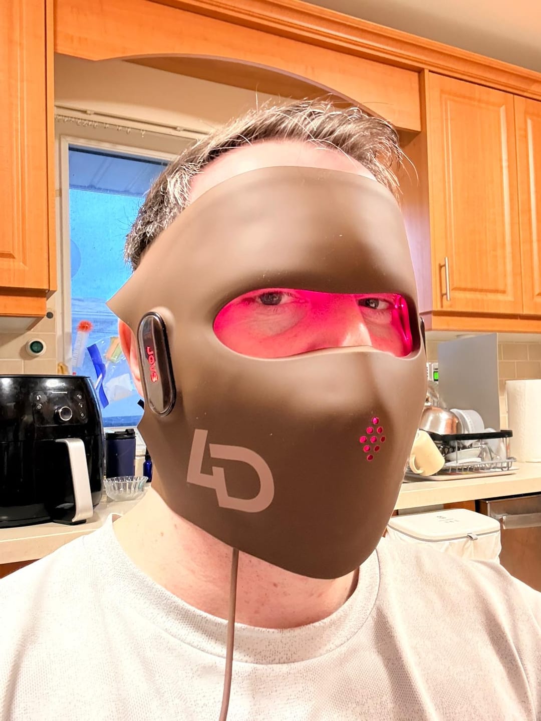 Customer photo review of JOVS 4D Laser Light Therapy Mask