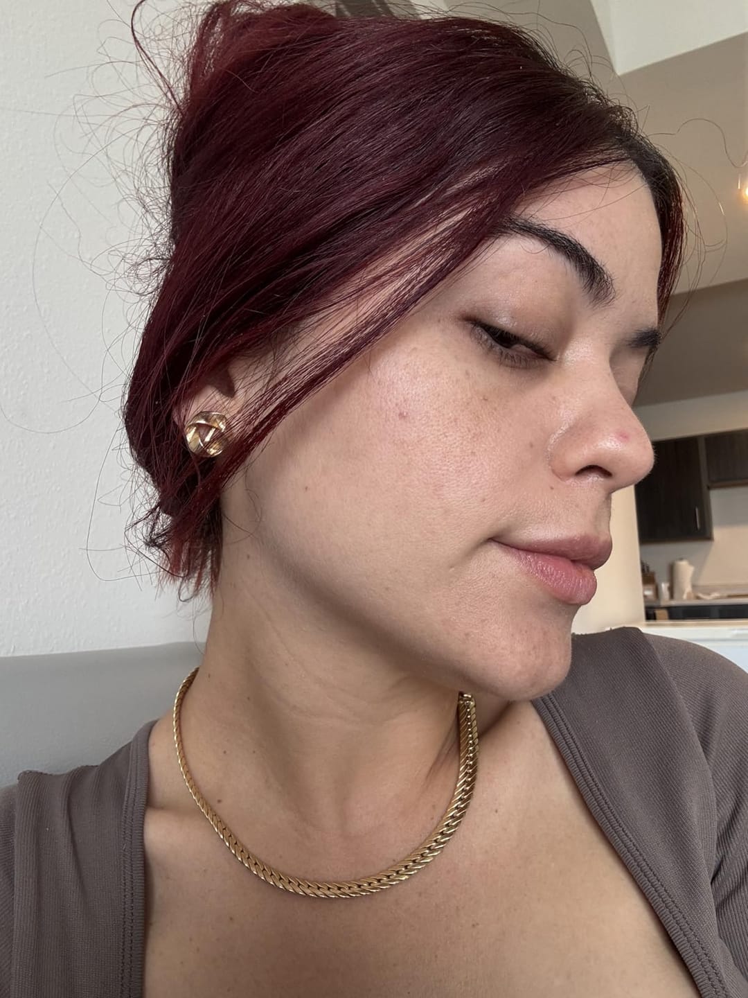 Customer photo review of CLEARSTEM® La solucion interna para el acne hormonal