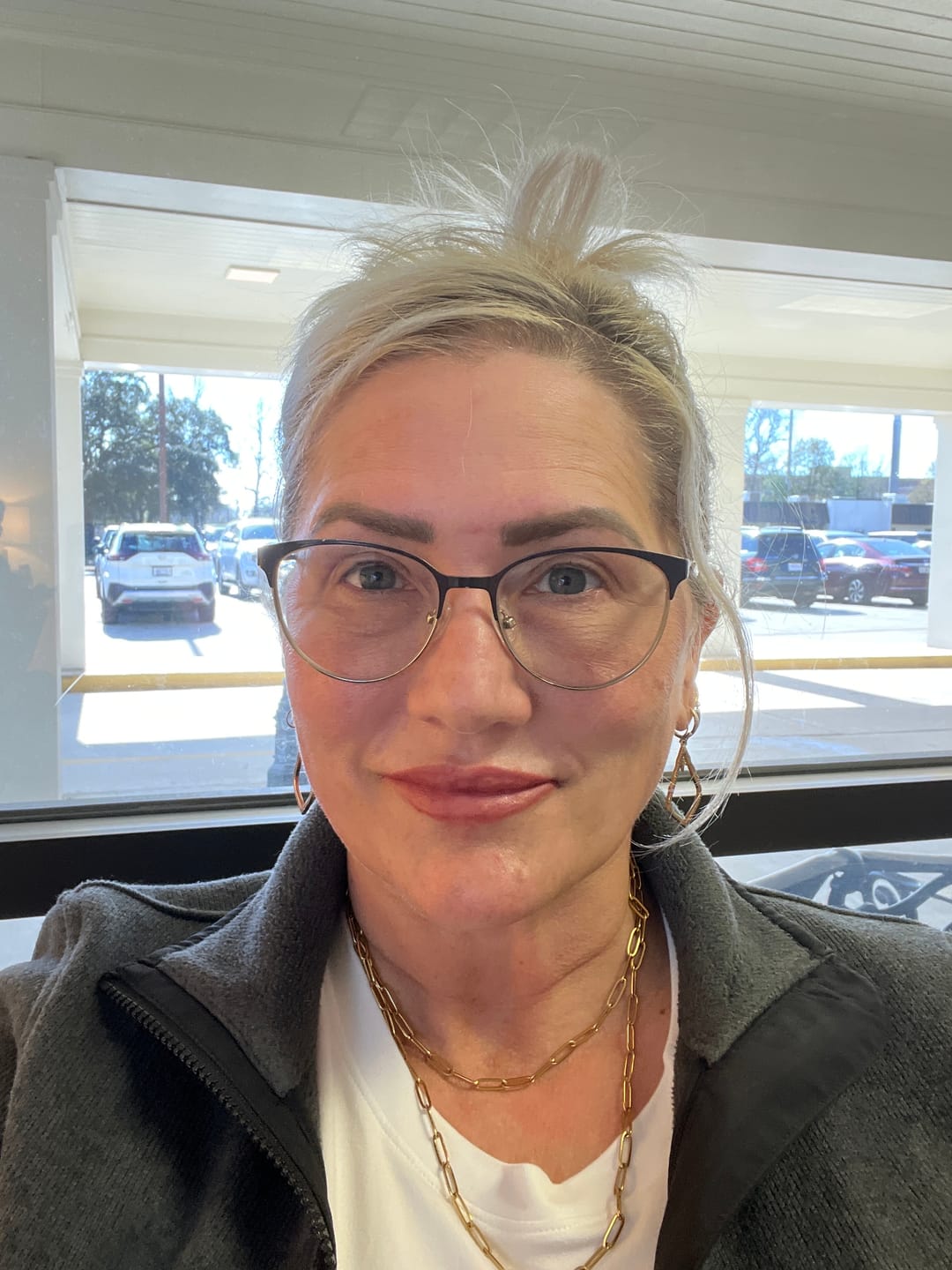 Customer photo review of Glov Serum-Infused Microneedle Eye Patches